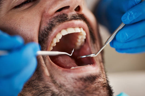 Best Mobile Emergency Dentist in Decatur, TN