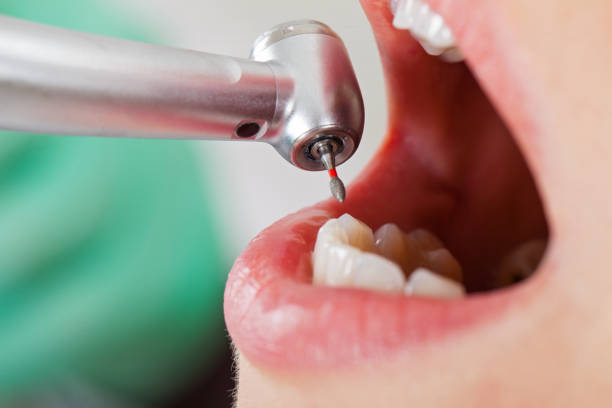 Best Pediatric Emergency Dentist in Decatur, TN
